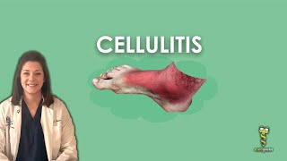 Cellulitis [upl. by Esinereb]