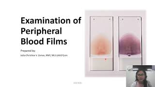 Examination of Peripheral Blood Smears [upl. by Kakalina]