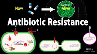 Antibiotic Resistance Animation [upl. by Aibsel428]