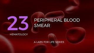 How to make Peripheral Blood Smears 3 ways [upl. by Orvas]