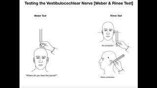 Interpreting the WeberRinne Tests EXPLAINED [upl. by Gudrin632]