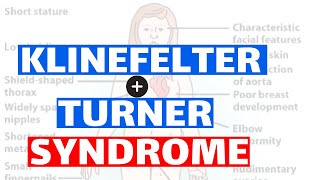 Klinefelter amp Turner syndrome  Pathology Clinical features Diagnosis and Treatment [upl. by Enoval503]