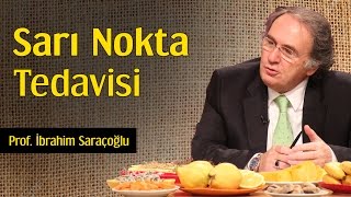 Sarı Nokta Tedavisi  Prof İbrahim Saraçoğlu [upl. by Welcher]