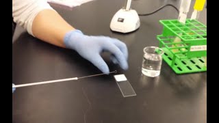 Bacterial smear preparation [upl. by Lemrej962]