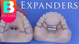 BRACES EXPLAINED Palatal Expanders [upl. by Portie360]