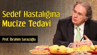 Sedef Hastalığına Mucize Tedavi  Prof İbrahim Saraçoğlu [upl. by Brownley685]