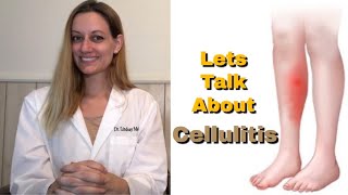 CELLULITIS Everything You Need To Know Symptoms Cause Risk Factors Treatment Prevention [upl. by Atinid295]