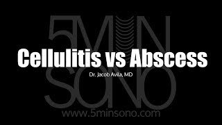 Differentiating Cellulitis from Abscess with POCUS [upl. by Nitsrek]