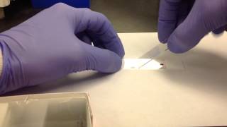 Hematology Making a Peripheral Blood Smear [upl. by Botzow898]