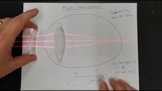 Vision Correction Normal Eyes Myopia Hyperopia Near amp Far Point Lens Power [upl. by Nomled893]