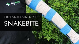 Pressure Immobilisation Technique for Snakebite [upl. by Broder]