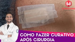 Como fazer curativo após uma cirurgia [upl. by Willtrude]