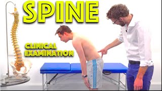 Spine Examination  Back Pain Assessment  4K  Clinical Skills  Dr Gill [upl. by Carmelina]