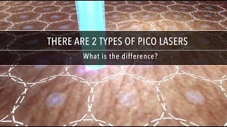 Why Are There Different Types of Pico Laser  Dr Kenneth Thean [upl. by Sawtelle980]