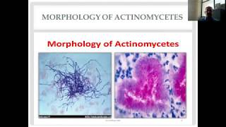 Actinomycetes and Nocardia Diverse Group of Gram Positive Bacilli [upl. by Nanette648]